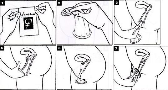 Cara memakai kondom wanita